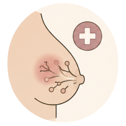 Mastitis & Blocked Ducts